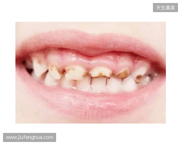 韦林顿确诊上唇部贯通伤；11、21牙半脱位；上颌前牙区牙槽骨骨折